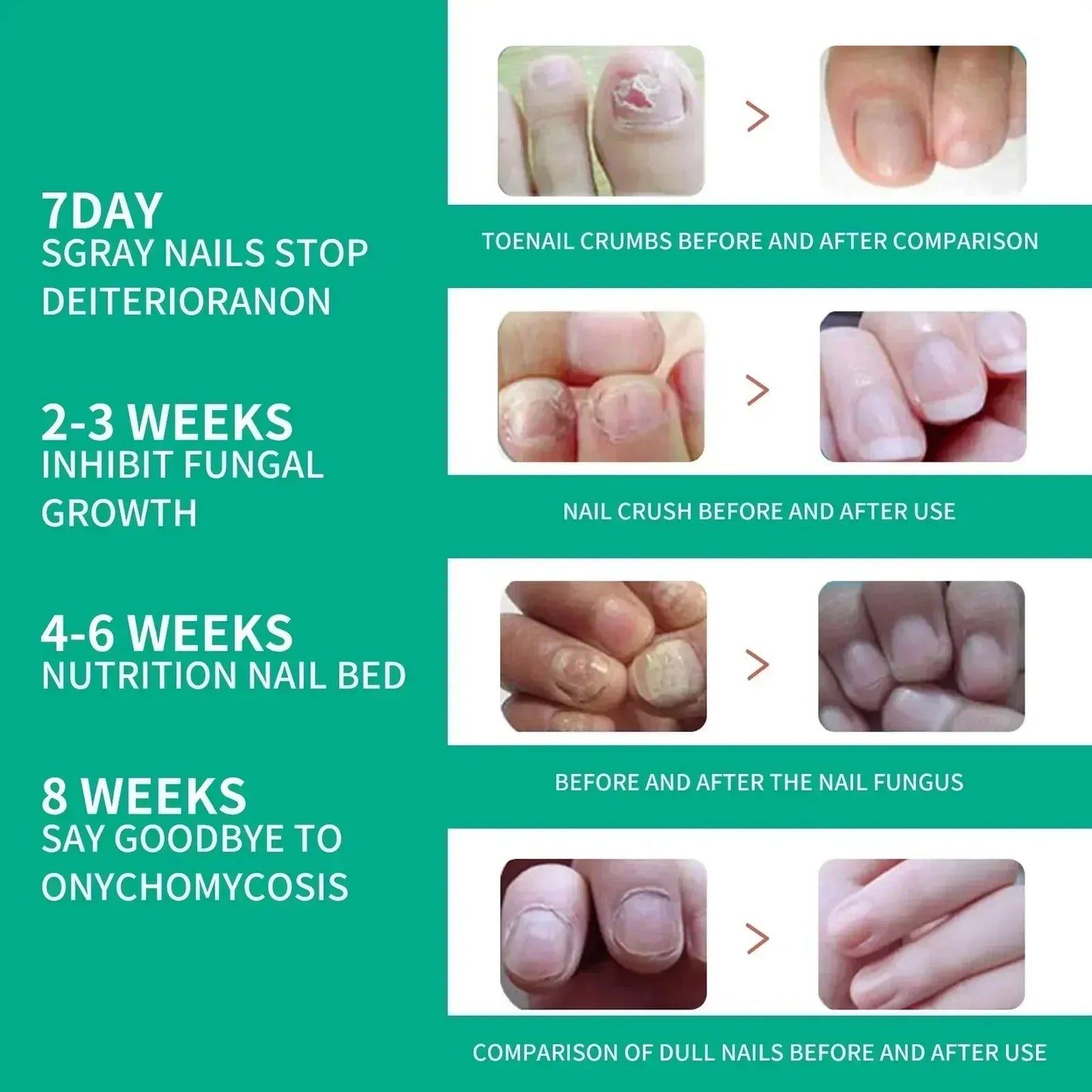 Nail Fungus Relief