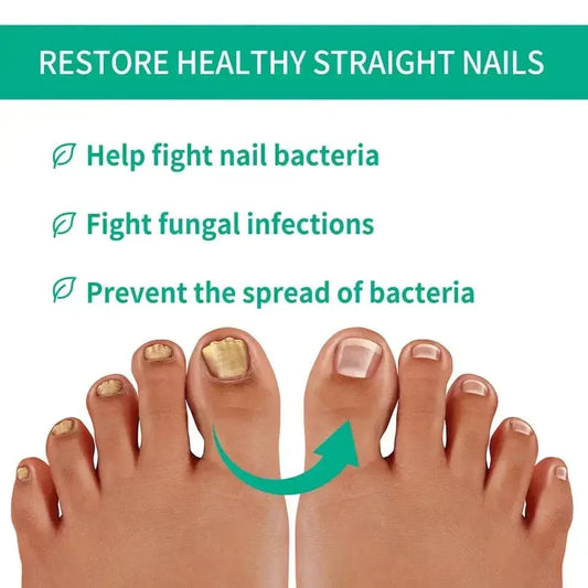 Nail Fungus Relief